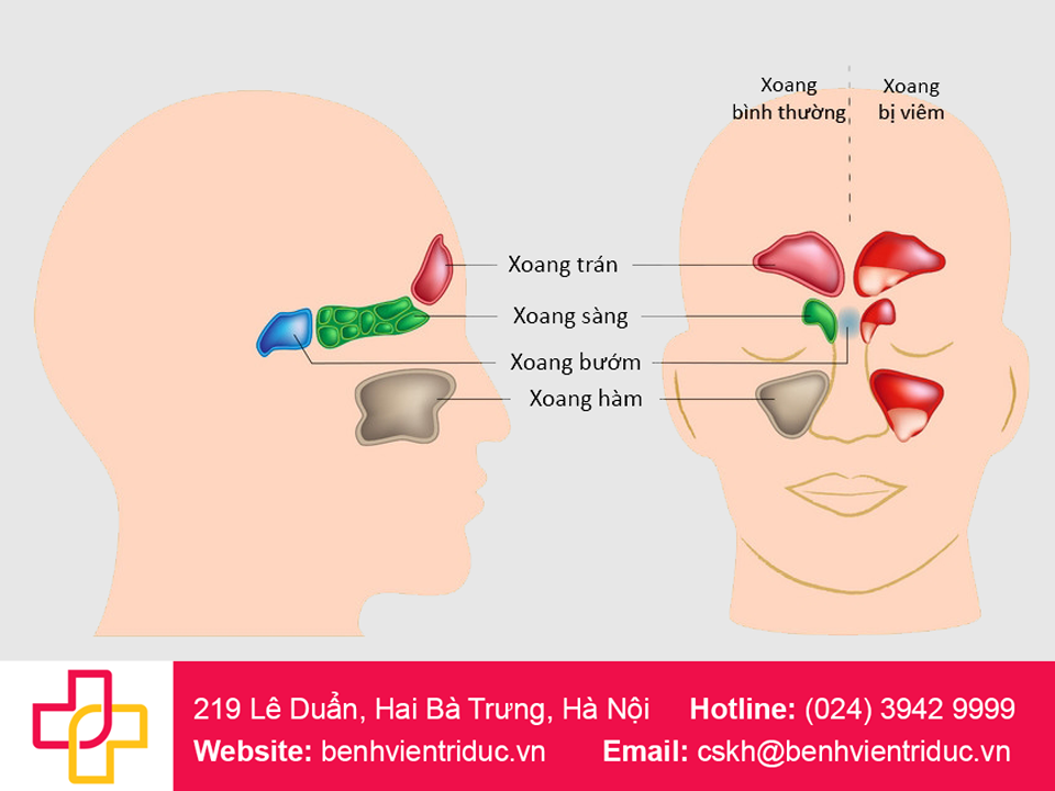 casc-vi-tri-xoang-o-tre-em