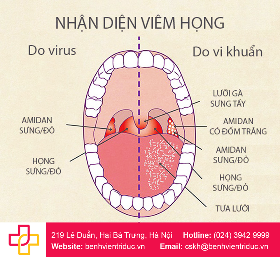 tre-bi-viem-hong -cach-nhan-dien