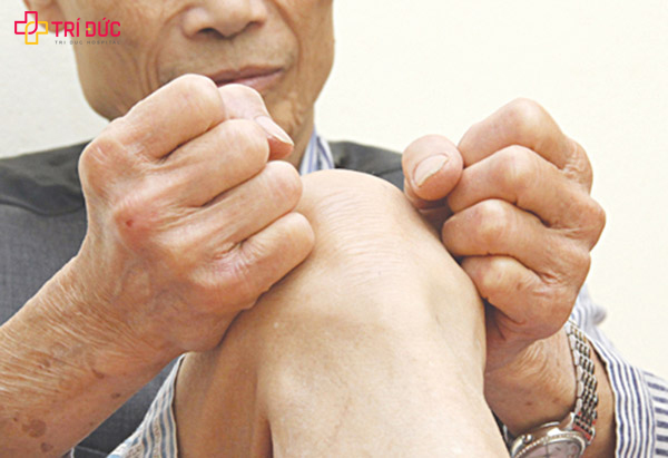 benh viem da khop dạng thap