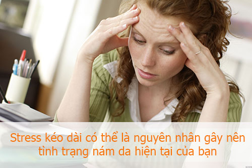 Stress cũng là một trong những nguyên nhân có thể gây nên nám và tàn nhang cho phụ nữ