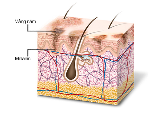 ngph_da-sam-nam