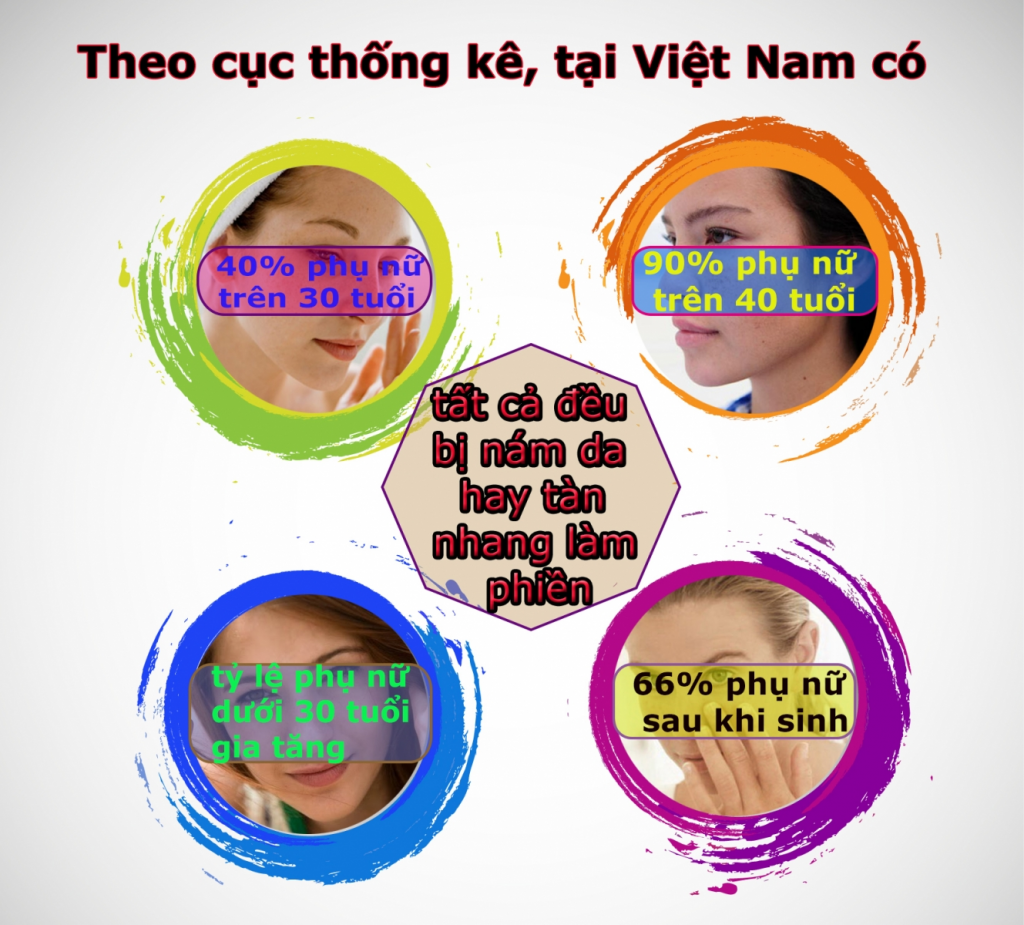 Nám da trở thành nỗi ám ảnh với phụ nữ Việt Nam
