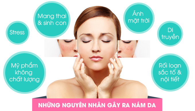 Những nguyên nhân chính gây ra nám da ở phụ nữ Việt